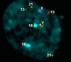 PGD_1