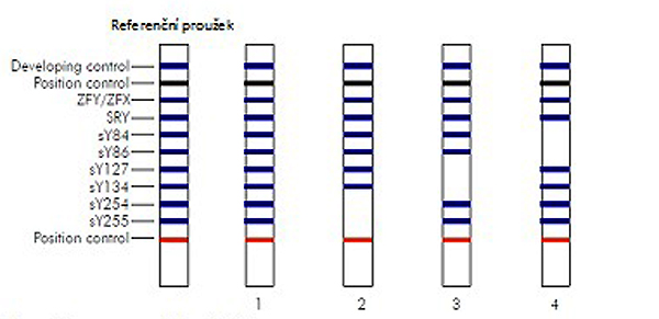 Molekulrn genetick vyeten mikrodelec Y chromozomu